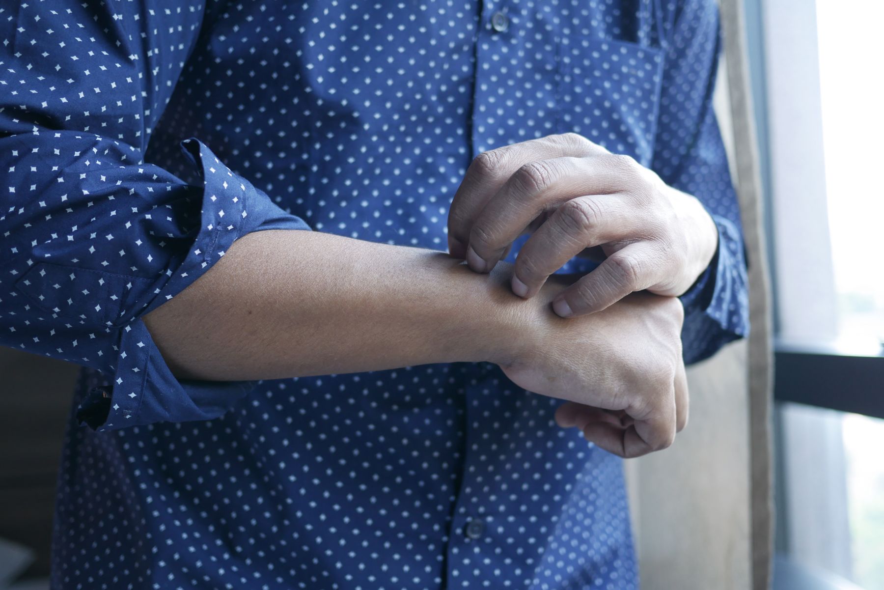 Hand scratching the opposite forearm beside a window