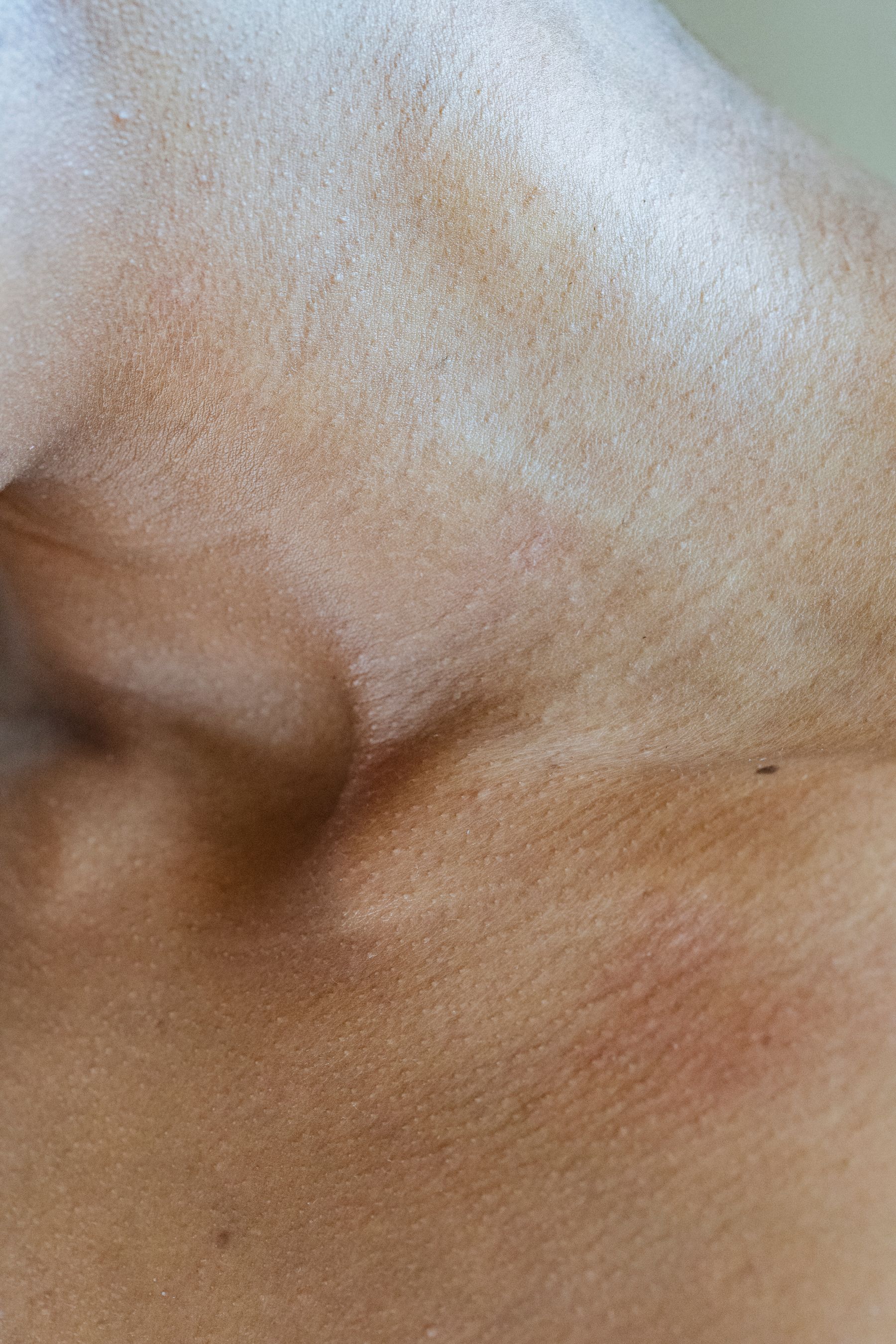 Close-up of neck and collarbone with a small pigmented skin mark